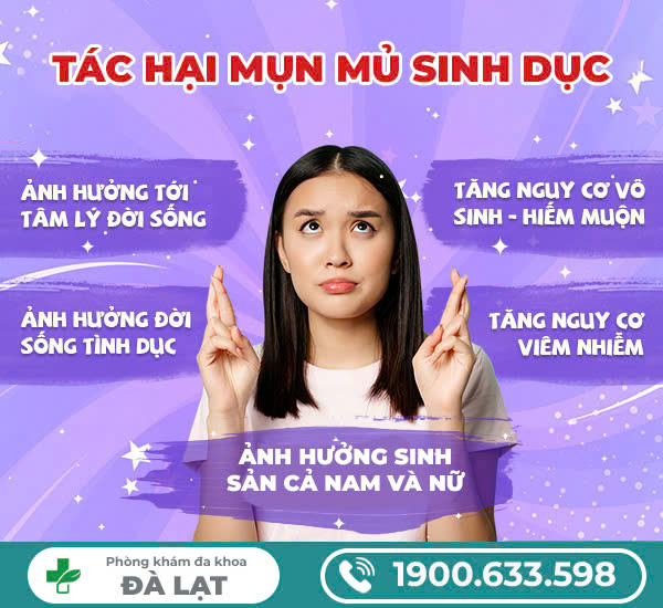 Hình ảnh minh họa